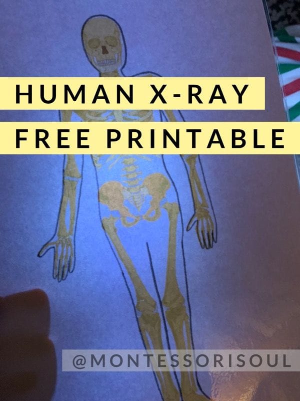 Free printable x rays